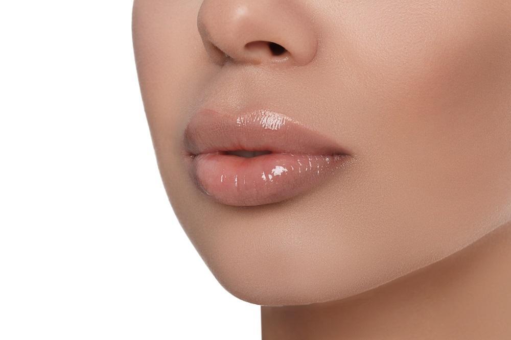 Fuller lips with juvederm