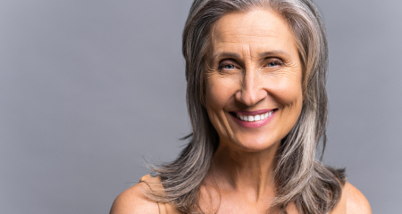 Age Spots