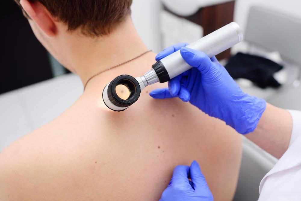 Mole check