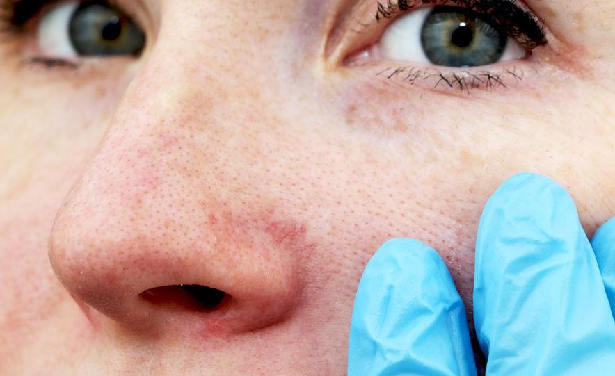 dermatology