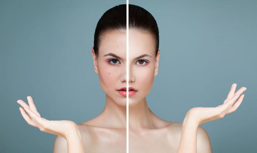 before and after dermatology