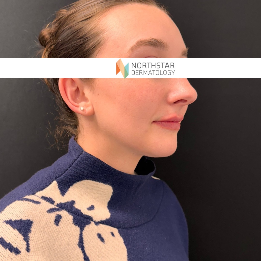 Northstar New Pt 2