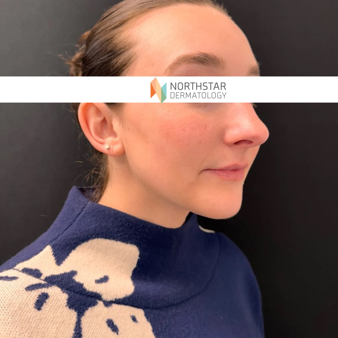 Northstar New pt. 2